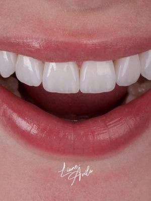 Estética do Sorriso