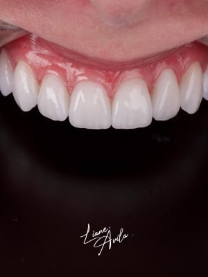 Estética do Sorriso