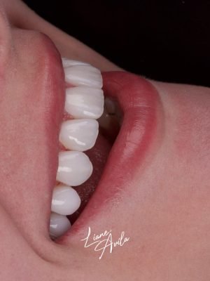 Estética do Sorriso