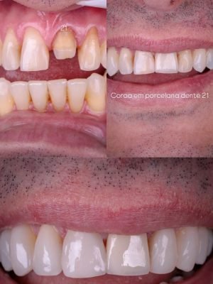 Estética do Sorriso